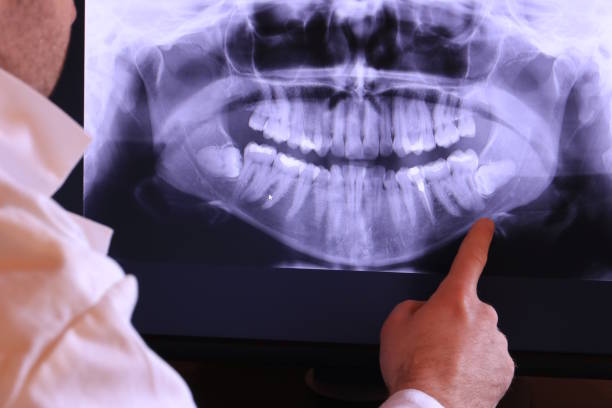 Best Emergency Treatment for Dental Infections or Abscesses in Bentleyville, PA