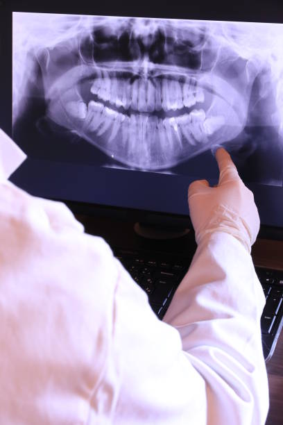 Best Emergency Dental Care for Broken or Chipped Teeth in Bentleyville, PA