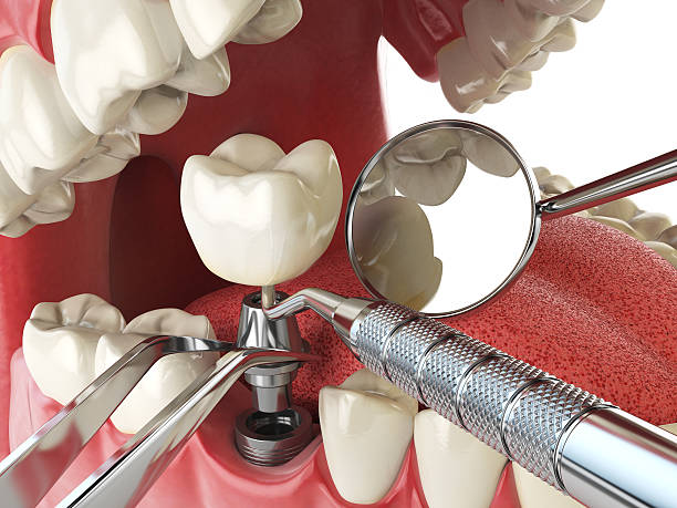 Best Emergency Gum Treatment in Bentleyville, PA