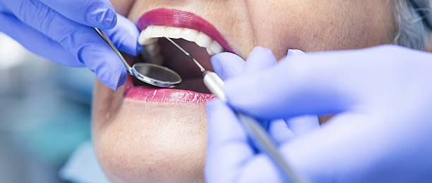 Best Emergency Root Canal Treatment in Bentleyville, PA